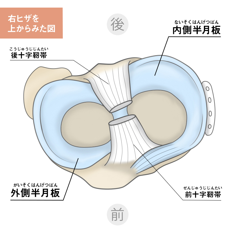 一般的にいわれる半月板損傷とは？